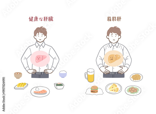 健康な肝臓と脂肪肝の男性のイラストセット