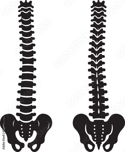 Black Silhouette Human Spine and Pelvis Anatomy Comparison human anatomy skeleton bones