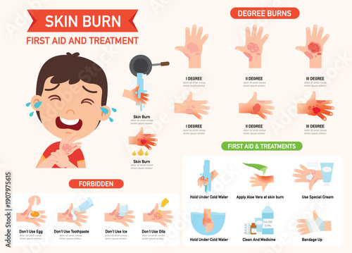 Skin Burn First Aid And Treatment Infographic