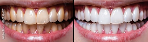 Macro image of human teeth comparing condition before and after whitening with visible improvement in color, cleanliness, and dental appearance.