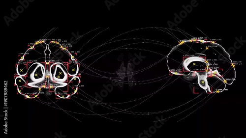 Dynamic brain-to-brain connections. Analysis of active areas of the brain. Visualization with markers.