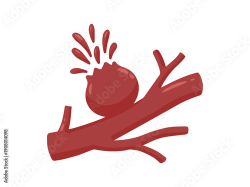 Ruptured Aneurysm Blood Vessel Clip Art
