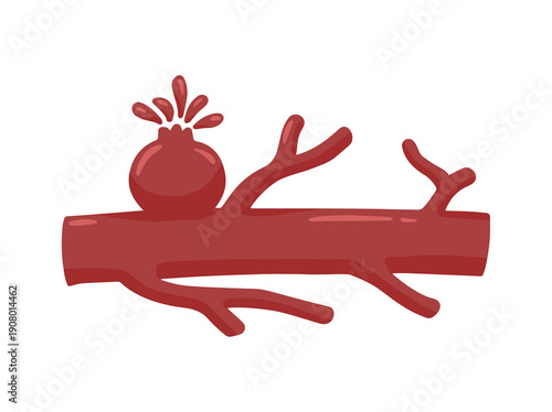 Ruptured Aneurysm Blood Vessel Illustration