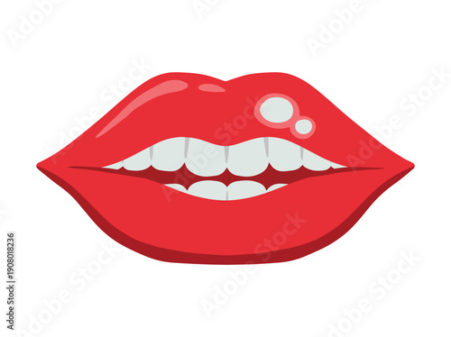 Ulcer Lip Disease Illustration
