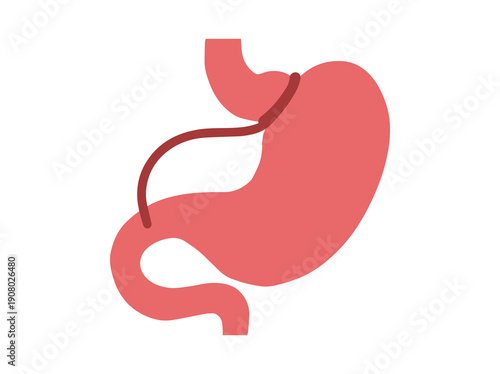 Hand Drawn Adjustable Gastric Band Surgery
