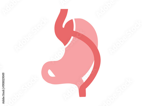 Roux en Y Gastric Bypass Surgery Illustration
