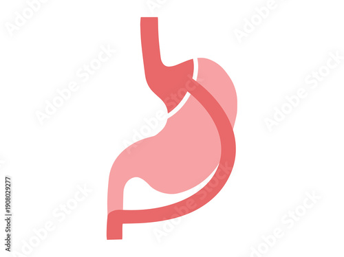 Roux en Y Gastric Bypass Surgery Illustration
