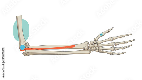 Medical illustration of the human arm bones including the humerus, radius, and ulna with joints and certain areas highlighted in color.