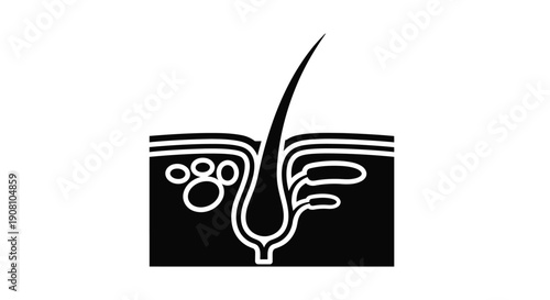 Diagram of a human hair follicle and surrounding skin layers