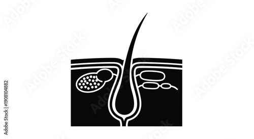 Diagram of a human hair follicle and skin cross section