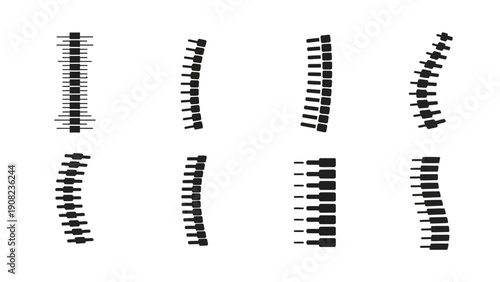 Spinal Column Deformities: Scoliosis and Kyphosis - Medical Illustration