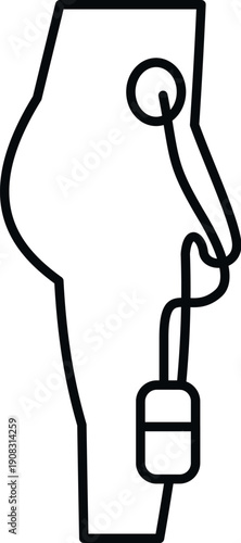 Person's leg showing an insulin pump for continuous glucose monitoring and management