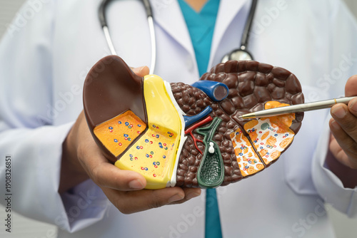 Cirrhosis, Liver cancer, fatty liver, Asian doctor with liver human model.