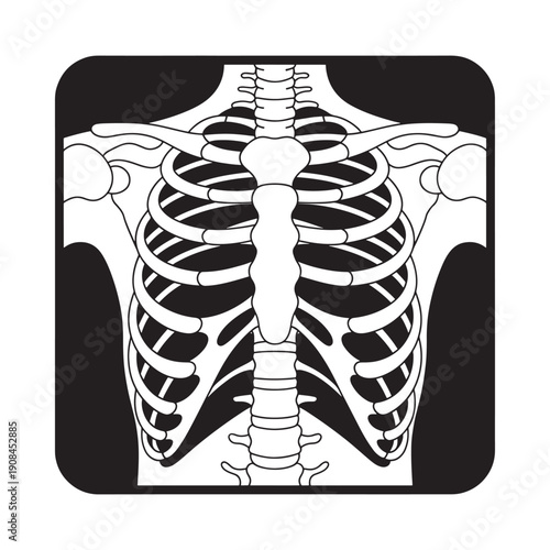 An x ray illustration depicts the human ribcage spine and shoulder girdle