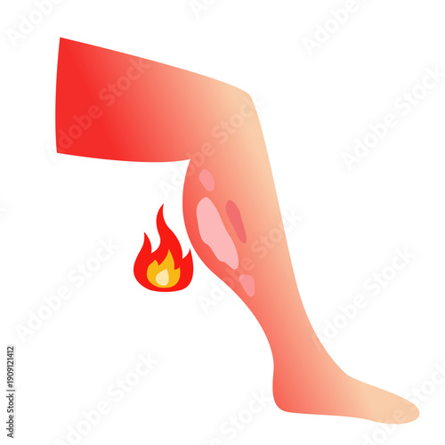 Burned skin. vector illustration design