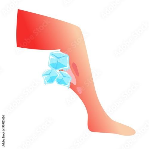 Burned skin. vector illustration design