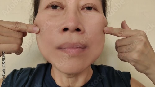 portrait the fingers holding the flabbiness and wrinkle beside the mouth, freckles and scar, blemish and Flabby skin on the face of the woman, health care and beauty concept.