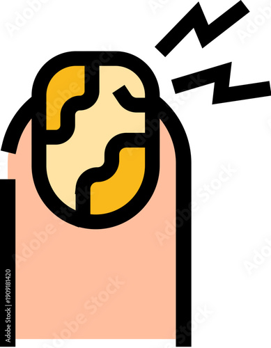 Fingernail showing an onychomycosis fungal infection with discoloration and thickness, symbolizing pain and discomfort associated with unhealthy nail conditions requiring dermatological attention