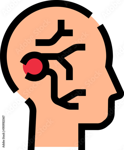 Human head profile visualizing a bursting brain aneurysm and cerebrovascular system, representing stroke, hemorrhage, or other neurological vessel diseases and treatment