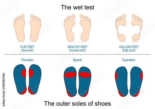 Wet test and outer soles of shoes. Normal, Supination, Pronation