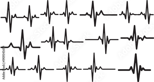 Multiple ECG heartbeat tracings on a white background displayed