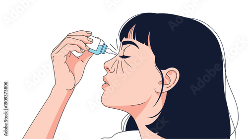 Young woman tilting her head back to apply medicated eye drops from a small blue bottle into her eye for relief and treatment.