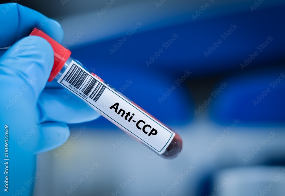 Obraz premium Blood sample tube for anti-CCP test analysis.