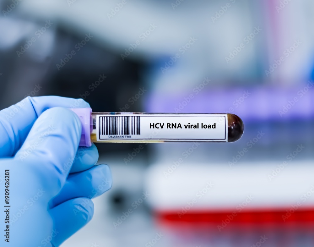 Fototapeta premium Blood sample tube for HCV RNA viral load test analysis.