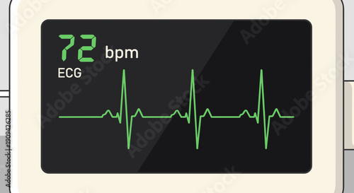 ECG Monitor Display with Heart Rate Reading.