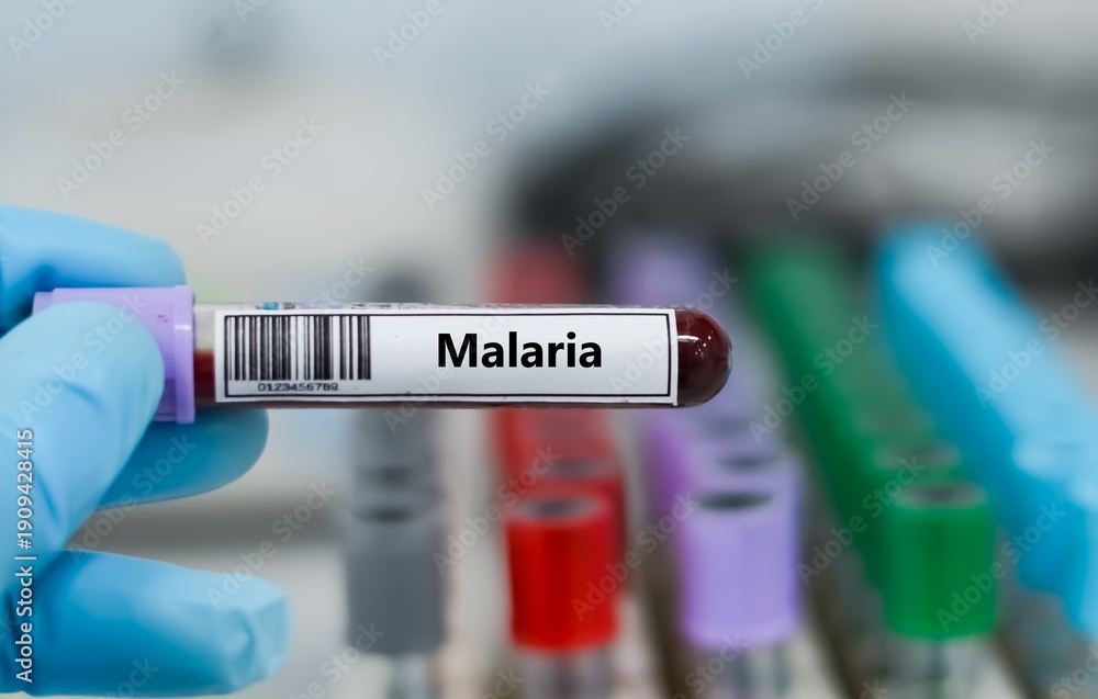 Obraz premium Blood sample tube for malaria test analysis.