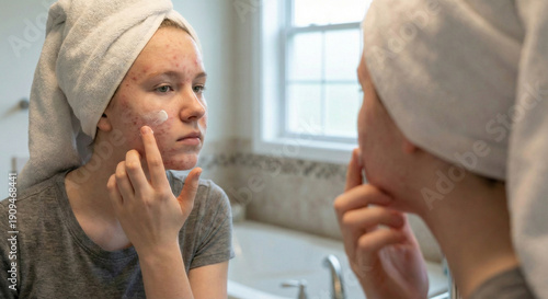 Wallpaper Mural Teen girl with acne applies white cream to cheek in bathroom mirror reflection, towel turban on head, gray t-shirt, cozy home skincare routine concept. Torontodigital.ca
