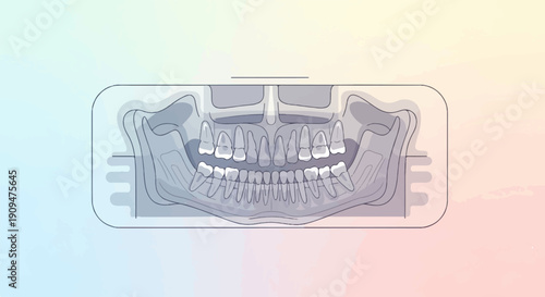 A simplified, line-art dental X-ray showing upper and lower jaw teeth