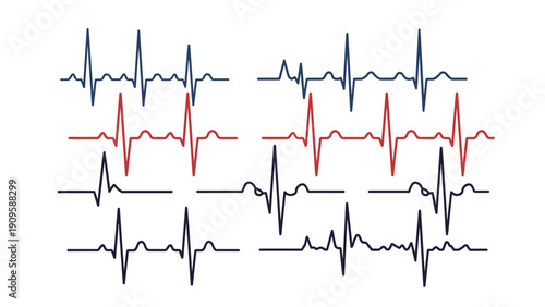Series of electrocardiogram pulse lines in blue and red colors illustrating heart rate monitoring and medical health technology.