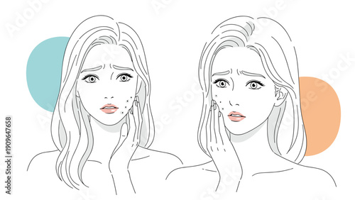 Illustration comparing a woman's face before and after skin treatment showing acne problems and clear healthy skin on a white background.
