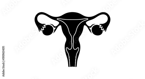 Illustration of female reproductive system anatomy viewed from front, highlighting uterus and ovaries, reference 4y7