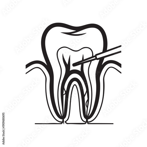 A black and white drawing of a tooth with a needle