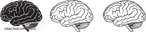 Three detailed brain illustrations in black and white