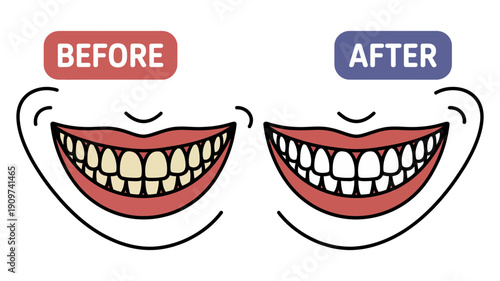 A charming cartoon illustration demonstrates the impressive before and after results of teeth whitening.