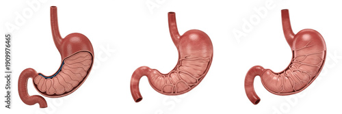 Foto Human stomach isolated on white background, gastric anatomy, stomach organ, fund