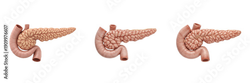 Tableau sur toile Human pancreas isolated on white background, pancreatic anatomy, pancreatic isle