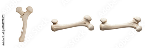 Canvastavla Human femur bone isolated on white background, thigh bone anatomy, proximal and