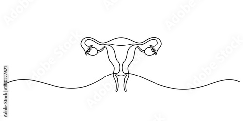 Continuous line drawing of female reproductive system showing tubal ligation procedure.