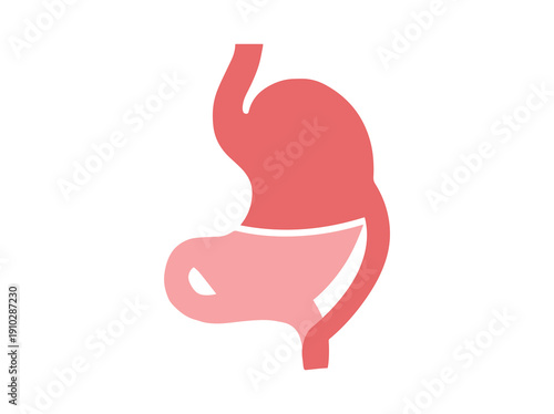 Biliopancreatic Diversion Surgery Illustration