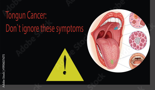PrintTongue Cancer Awareness Key Symptoms You Shouldn’t Ignore