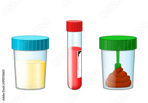 Samples for Medical Diagnostics. Laboratory test tube containing blood specimen. Urine and stool in plastic jars for Medical analysis.