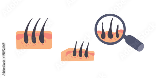 follicle and hair growth process in skin layer