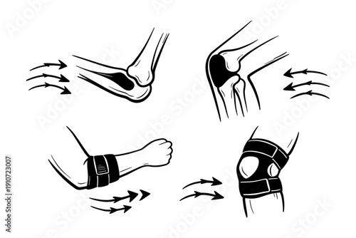Joint support brace illustrations: elbow and knee anatomy diagrams