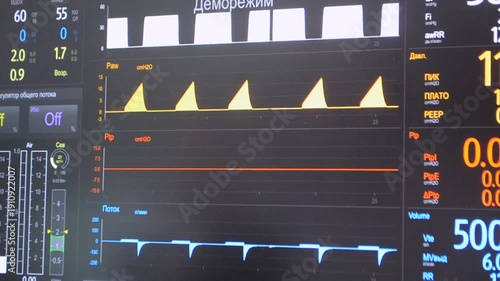 Modern patient monitor close-up. Electronic health monitor displaying medical indicators graphs of patient vital activity. Cardiogram ECG Pulse. Medical vital signs. Screen hospital computer monitor