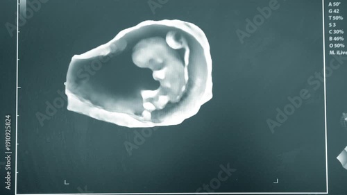 Ultrasound on monitor close-up. Ultrasound image on computer monitor screen. Ultrasound examination. Sonography sonogram. Monitoring diagnostic medical healthcare system. Ultrasonography ultrasonic.