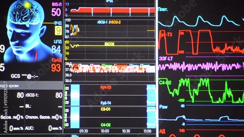 Modern patient monitor close-up. Electronic health monitor displaying medical indicators graphs of patient vital activity. Medical signs. Screen hospital computer monitor Cardiogram ECG Pulse